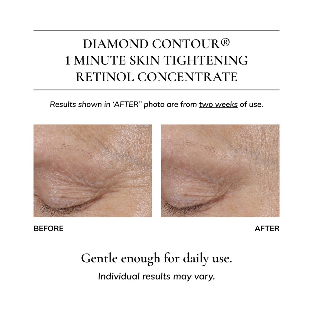 🎀 Kaplan MD Diamond Contour Retinol Concentrate 50ml ✨ Brand New In Box 🎀 - Picture 6 of 10